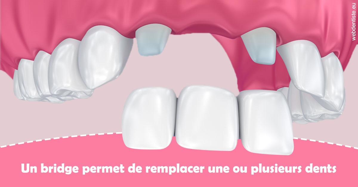 https://dr-madi-caroline.chirurgiens-dentistes.fr/Bridge remplacer dents 2