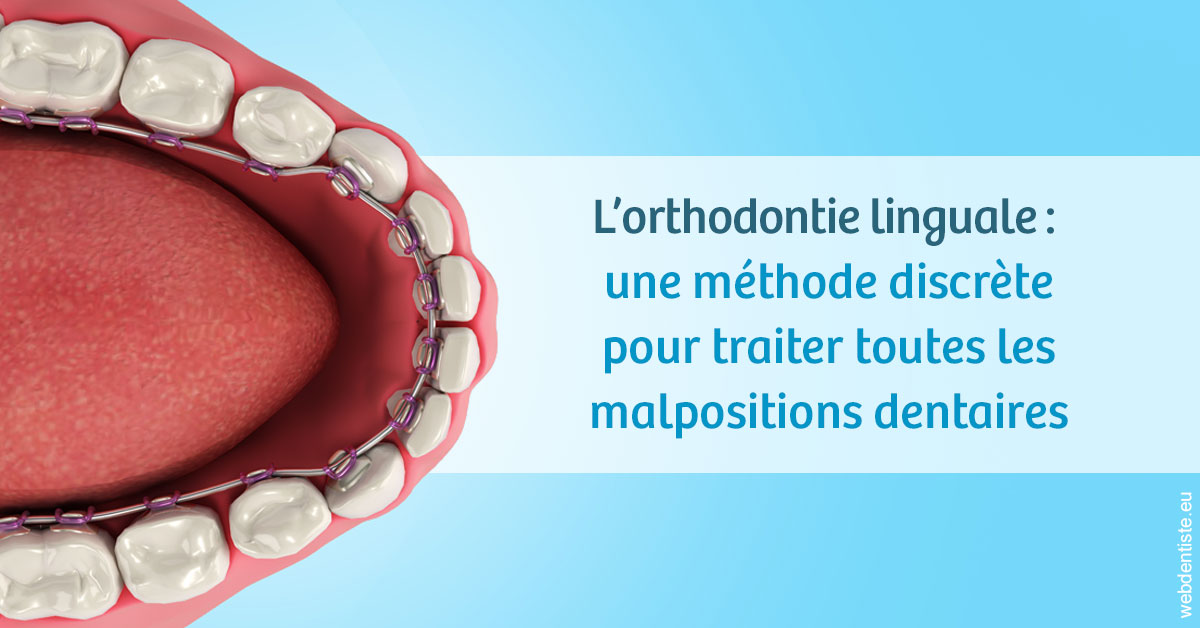 https://dr-madi-caroline.chirurgiens-dentistes.fr/L'orthodontie linguale 1