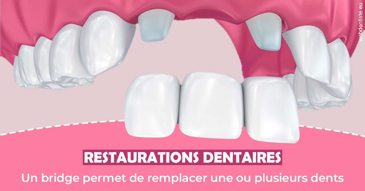 https://dr-madi-caroline.chirurgiens-dentistes.fr/Bridge remplacer dents 2