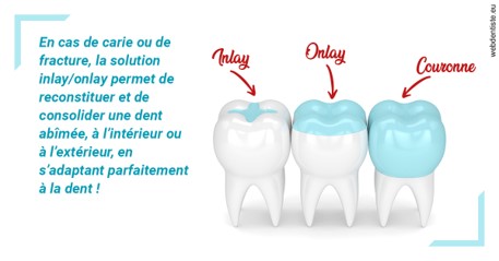 https://dr-madi-caroline.chirurgiens-dentistes.fr/L'INLAY ou l'ONLAY
