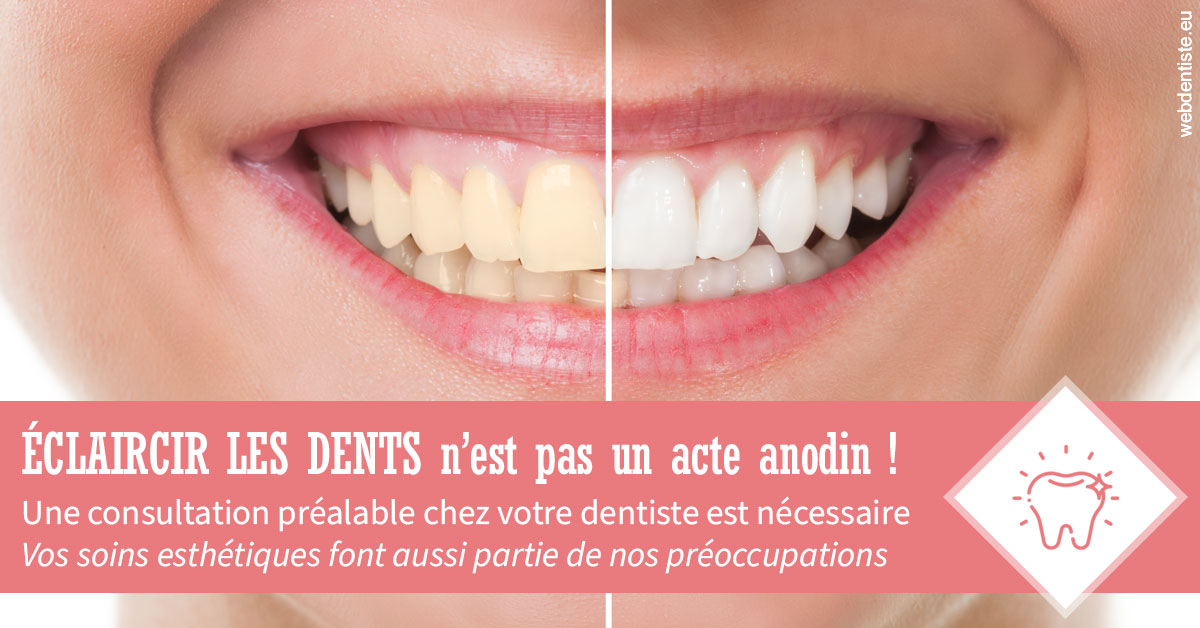 https://dr-madi-caroline.chirurgiens-dentistes.fr/Eclaircir les dents 1