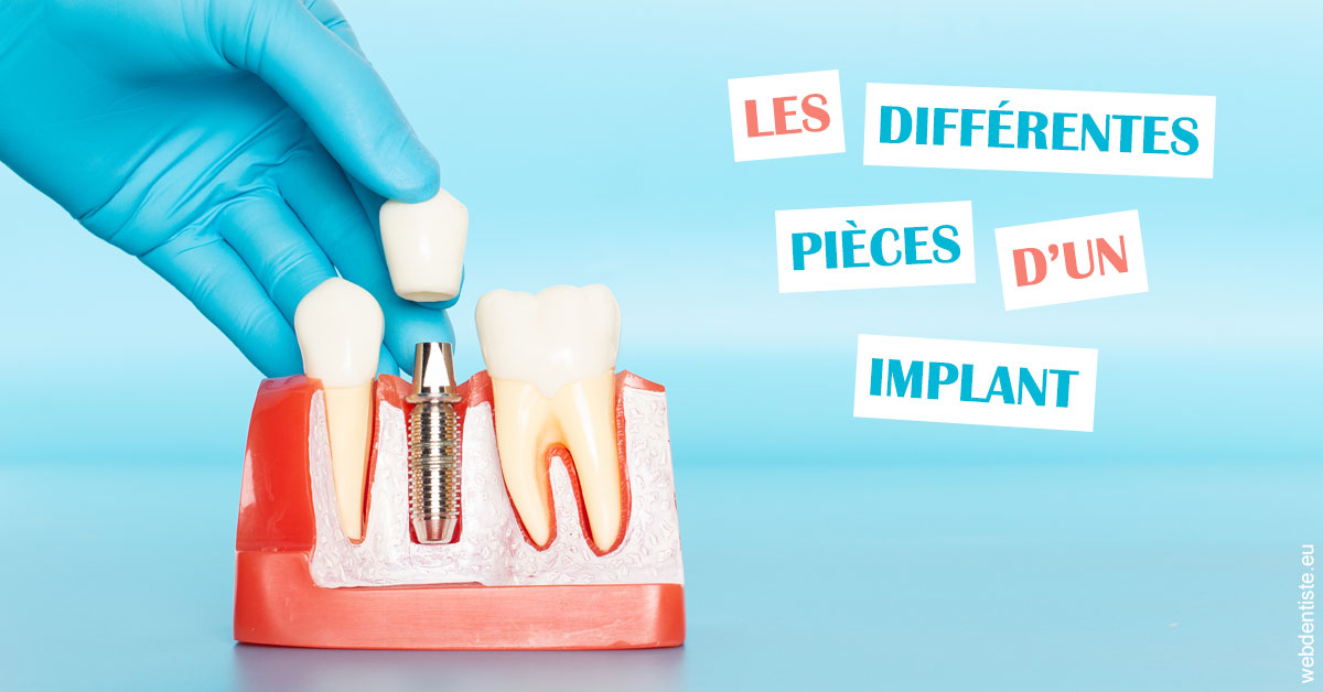 https://dr-madi-caroline.chirurgiens-dentistes.fr/Les différentes pièces d’un implant 2