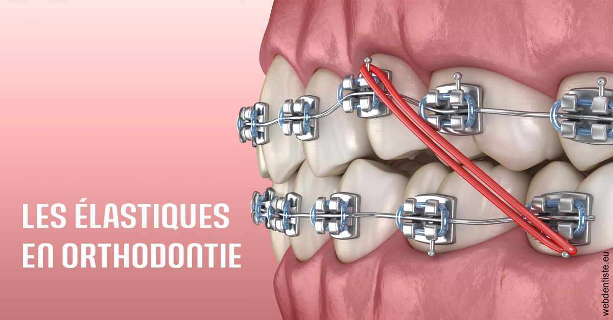 https://dr-madi-caroline.chirurgiens-dentistes.fr/Elastiques orthodontie 2